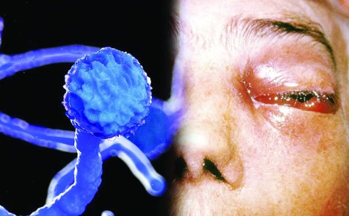 mucormycosis